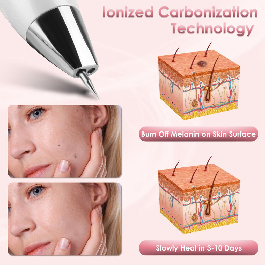 Wart & Freckle Remover with Needles